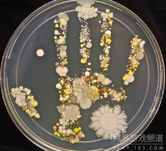 一个八岁孩子玩耍后，从手上培养出的细菌